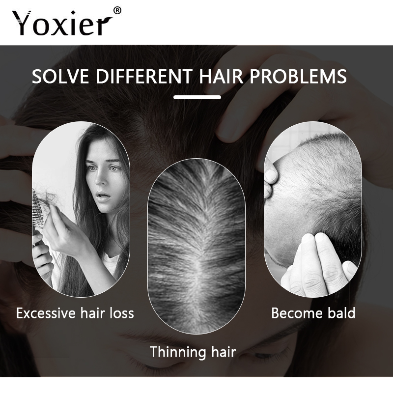 Intensive Growth Serum Prevent - огляд і ціна Hair Care Treatment