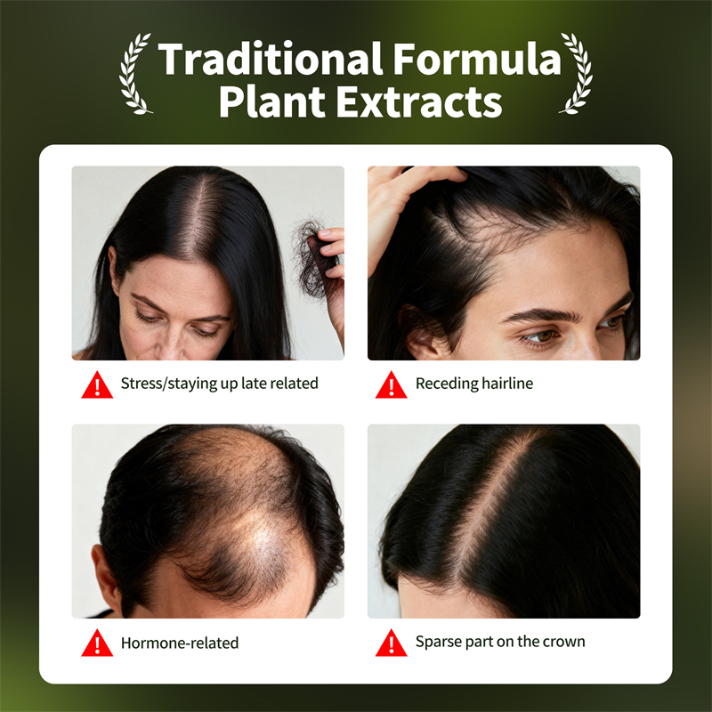 Natural Hair Growth Set Usman  - огляд і ціна Hair Care Herbal