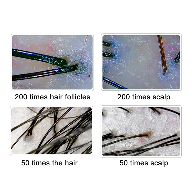 200/50X Skin Hair Scalp Detect - огляд і ціна Hair Porosity Test