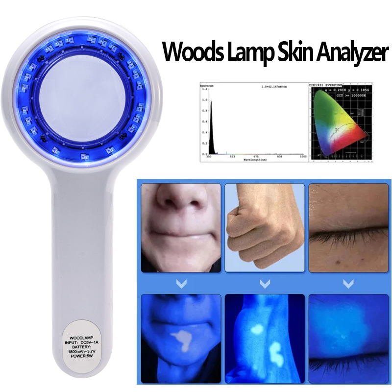 NEW Woods Lamp Skin Analyzer P - огляд і ціна Hair Porosity Test