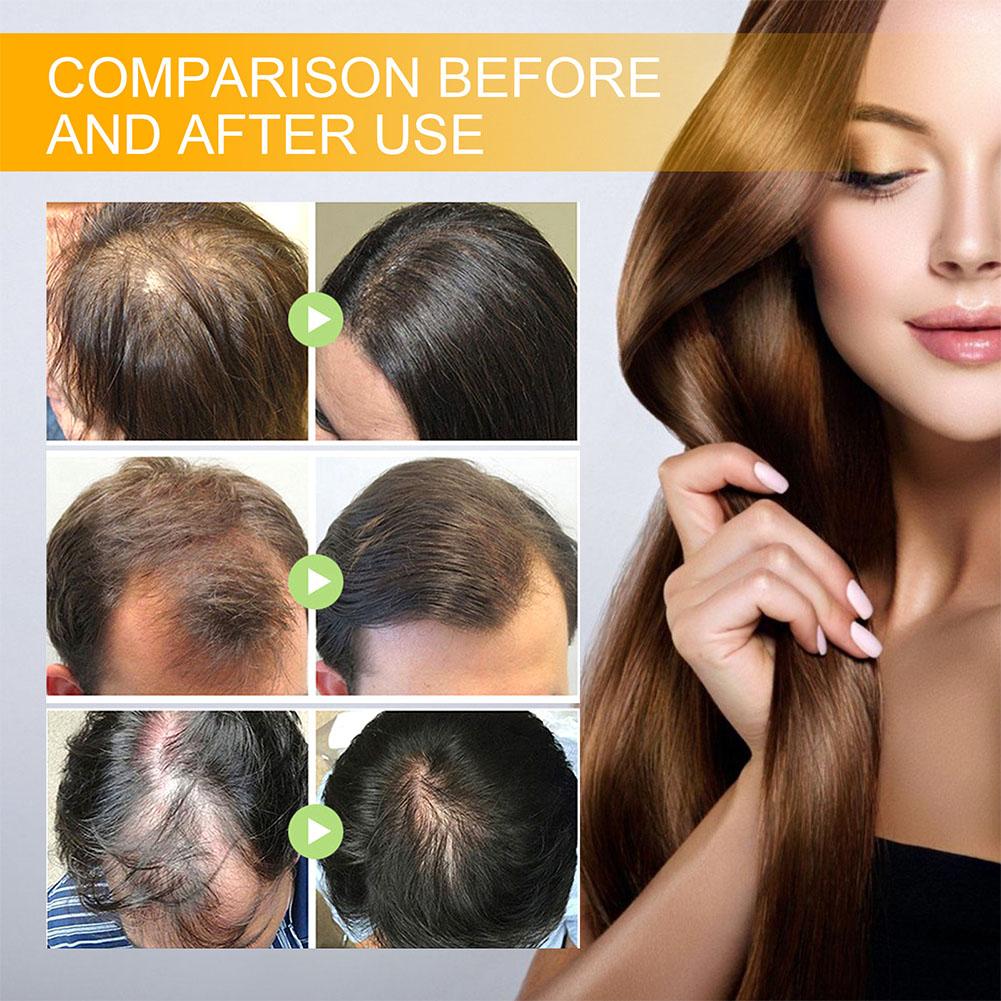 5/3/1pcs Biotin Fast Hair Grow - огляд і ціна Hair Care Herbal