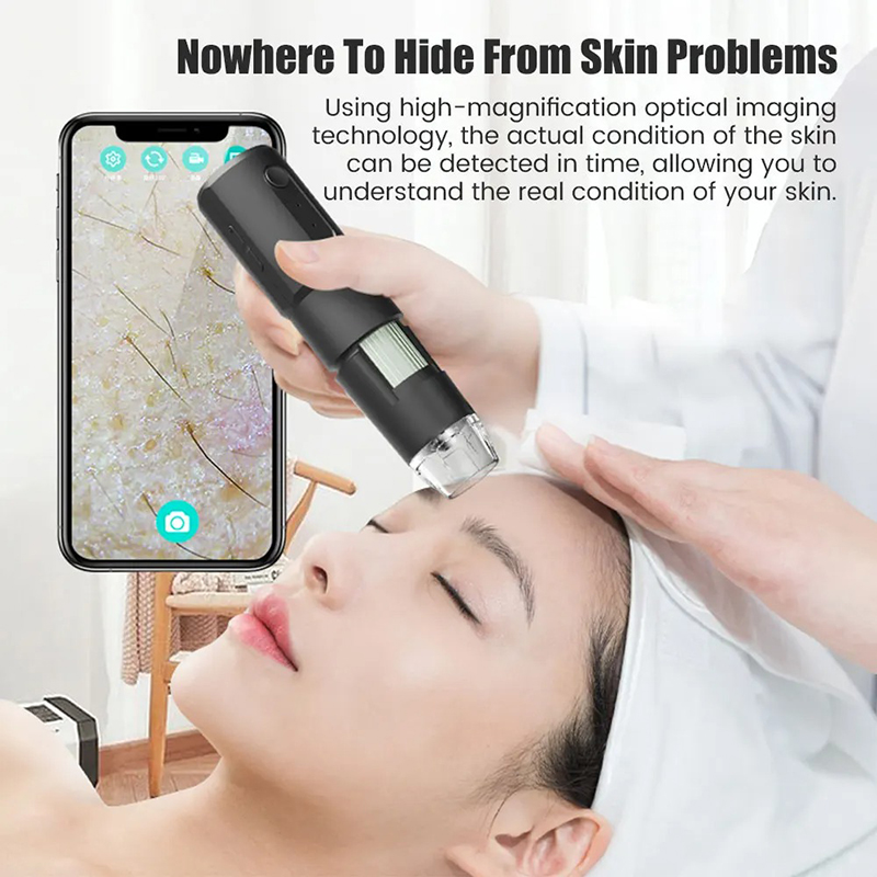 Wireless Dermatoscope Scalp Sk - огляд і ціна Hair Porosity Test